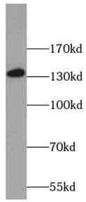 Western Blot: NRDE2 Antibody - BSA Free [NBP3-47825] - MCF-7 cells were subjected to SDS PAGE followed by western blot with ( NRDE2 Antibody) at dilution of 1:600