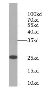 Western Blot: SMCO3 Antibody - BSA Free [NBP3-47827] - Mouse brain tissue were subjected to SDS PAGE followed by western blot with ( SMCO3 Antibody) at dilution of 1:600