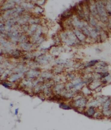 Immunohistochemistry: SMCO3 Antibody - BSA Free [NBP3-47827] - Immunohistochemistry of paraffin-embedded human colon tissue slide using (SMCO3 antibody) at dilution of 1:200