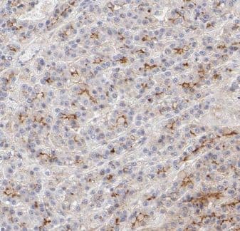 Immunohistochemistry IFTAP Antibody - BSA Free