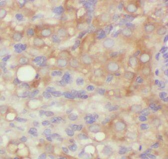 Immunohistochemistry: AAMDC Antibody - BSA Free [NBP3-47833] - Immunohistochemistry of paraffin-embedded human ovary using (AAMDC Antibody) at dilution of 1:50