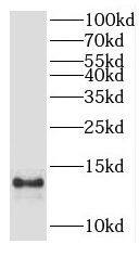 Western Blot AAMDC Antibody - BSA Free