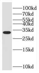 Western Blot NKAPD1 Antibody - BSA Free