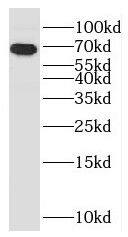 Western Blot: CCDC7 Antibody - BSA Free [NBP3-47838] - A549 cells were subjected to SDS PAGE followed by western blot with (CCDC7 Antibody) at dilution of 1:600