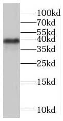 Western Blot: spatial Antibody - BSA Free [NBP3-47840] - HeLa cells were subjected to SDS PAGE followed by western blot with (spatial Antibody) at dilution of 1:600