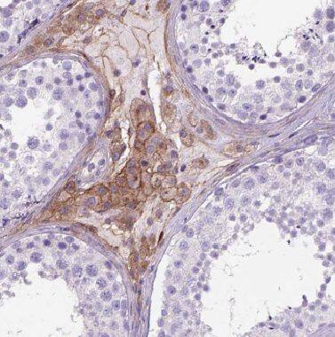 Immunohistochemistry BZW1 Antibody - BSA Free