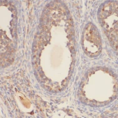 Immunohistochemistry BTG4 Antibody - BSA Free