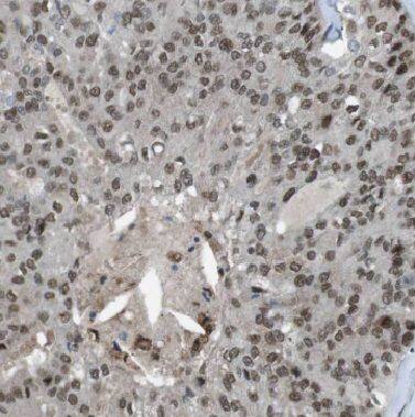Immunohistochemistry BTG1 Antibody - BSA Free