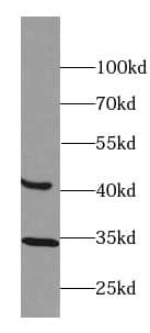 Western Blot: BTBD8 Antibody - BSA Free [NBP3-47847] - HEK-293 cells were subjected to SDS PAGE followed by western blot with ( BTBD8 Antibody) at dilution of 1:300