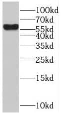 Western Blot BTBD16 Antibody - BSA Free