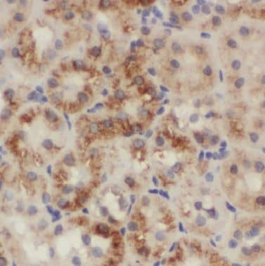 Immunohistochemistry BTBD16 Antibody - BSA Free