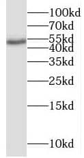 Western Blot: BRUNOL6 Antibody - BSA Free [NBP3-47849] - Human brain tissue were subjected to SDS PAGE followed by western blot with (BRUNOL6 antibody) at dilution of 1:500