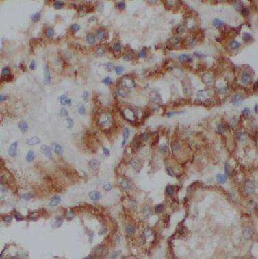Immunohistochemistry: BRUNOL6 Antibody - BSA Free [NBP3-47849] - Immunohistochemistry of paraffin-embedded human kidney using (BRUNOL6 antibody) at dilution of 1:50