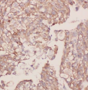 Immunohistochemistry BPIL1 Antibody - BSA Free