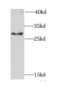 Western Blot: BPGM Antibody - BSA Free [NBP3-47856] - HeLa cells were subjected to SDS PAGE followed by western blot with (BPGM antibody) at dilution of 1:1000
