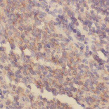 Immunohistochemistry: BIN2 Antibody - BSA Free [NBP3-47858] - Immunohistochemistry of paraffin-embedded human spleen using (BIN2 antibody) at dilution of 1:100