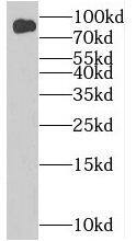 Western Blot: BIN2 Antibody - BSA Free [NBP3-47858] - U-937 cells were subjected to SDS PAGE followed by western blot with (BIN2 Antibody) at dilution of 1:600