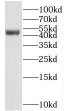 Western Blot: BEN Domain Containing 5 Antibody - BSA Free [NBP3-47863] - Mouse liver tissue were subjected to SDS PAGE followed by western blot with ( BEN Domain Containing 5 Antibody) at dilution of 1:800