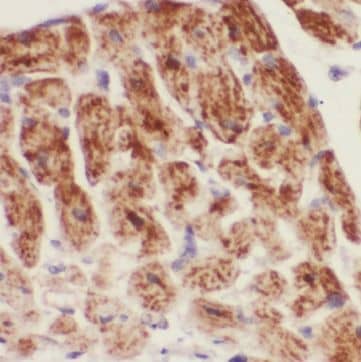 Immunohistochemistry CCDC4 Antibody - BSA Free