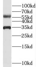 Western Blot CCDC4 Antibody - BSA Free