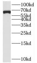 Western Blot: Begain Antibody - BSA Free [NBP3-47865] - HeLa cells were subjected to SDS PAGE followed by western blot with (Begain antibody) at dilution of 1:1000
