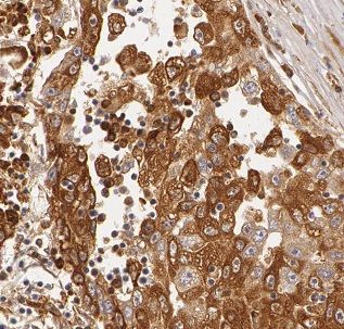 Immunohistochemistry: BDH1 Antibody - BSA Free [NBP3-47866] - Immunohistochemistry of paraffin-embedded human liver using (BDH1 antibody) at dilution of 1:50