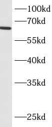 Western Blot: BCO2 Antibody - BSA Free [NBP3-47867] - L02 cells were subjected to SDS PAGE followed by western blot with (BCO2 antibody) at dilution of 1:800