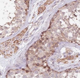 Immunohistochemistry BCMO1 Antibody - BSA Free