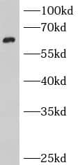 Western Blot: BCMO1 Antibody - BSA Free [NBP3-47868] - COLO 320 cells were subjected to SDS PAGE followed by western blot with (BCMO1 Antibody) at dilution of 1:300