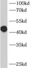 Western Blot: BCL7B Antibody - BSA Free [NBP3-47869] - HeLa cells were subjected to SDS PAGE followed by western blot with (BCL7B antibody) at dilution of 1:400