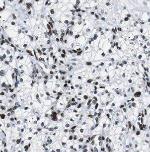 Immunohistochemistry BCKDHB Antibody - BSA Free