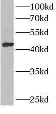 Western Blot BCAT1 Antibody - BSA Free