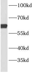 Western Blot BBS9 Antibody - BSA Free