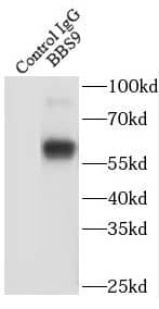 Immunoprecipitation: BBS9 Antibody - BSA Free [NBP3-47877] - IP Result of anti-BBS9 (IP:, 4ug; Detection: 1:500) with mouse testis tissue lysate 4000ug.