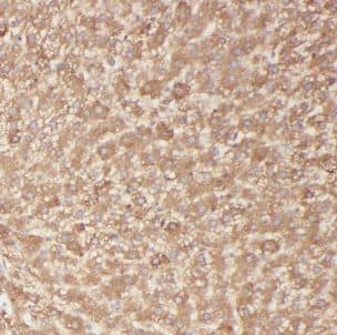 Immunohistochemistry: BBS9 Antibody - BSA Free [NBP3-47877] - Immunohistochemistry of paraffin-embedded human liver using (BBS9 antibody) at dilution of 1:50