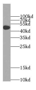 Western Blot: TTC8 Antibody - BSA Free [NBP3-47878] - Mouse testis tissue were subjected to SDS PAGE followed by western blot with (TTC8 antibody) at dilution of 1:300
