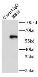 Immunoprecipitation TTC8 Antibody - BSA Free