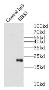 Immunoprecipitation: ARL6 Antibody - BSA Free [NBP3-47880] - IP Result of anti-ARL6 (IP:, 3ug; Detection: 1:600) with rat brain tissue lysate 5200ug.