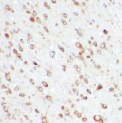 Immunohistochemistry BBS1 Antibody - BSA Free