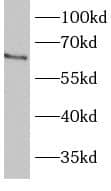 Western Blot BBS1 Antibody - BSA Free