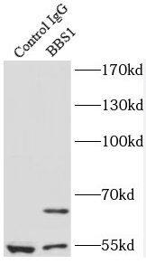 Immunoprecipitation BBS1 Antibody - BSA Free