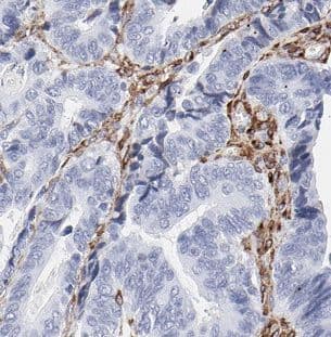 Immunohistochemistry beta-1,4-Galactosyltransferase 2/B4GalT2 Antibody - BSA Free