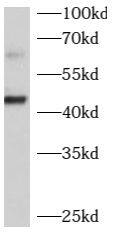 Western Blot: beta-1,4-Galactosyltransferase 2/B4GalT2 Antibody - BSA Free [NBP3-47893] - PC-3 cells were subjected to SDS PAGE followed by western blot with (beta-1,4-Galactosyltransferase 2/B4GalT2 antibody) at dilution of 1:1000
