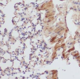 Immunohistochemistry B3GNT5 Antibody - BSA Free
