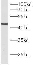 Western Blot B3GNT5 Antibody - BSA Free