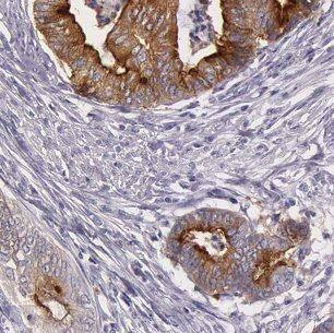 Immunohistochemistry B3GALTL Antibody - BSA Free