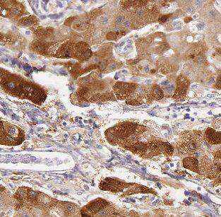 Immunohistochemistry B3GALT6 Antibody - BSA Free