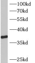 Western Blot B3GALT6 Antibody - BSA Free