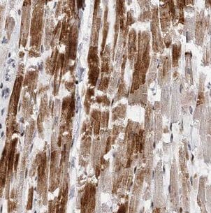 Immunohistochemistry: B3GALT2 Antibody - BSA Free [NBP3-47900] - Immunohistochemistry of paraffin-embedded human heart using (B3GALT2 antibody) at dilution of 1:50
