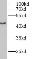 Western Blot: B3GALT2 Antibody - BSA Free [NBP3-47900] - Mouse brain tissue were subjected to SDS PAGE followed by western blot with (B3GALT2 antibody) at dilution of 1:800